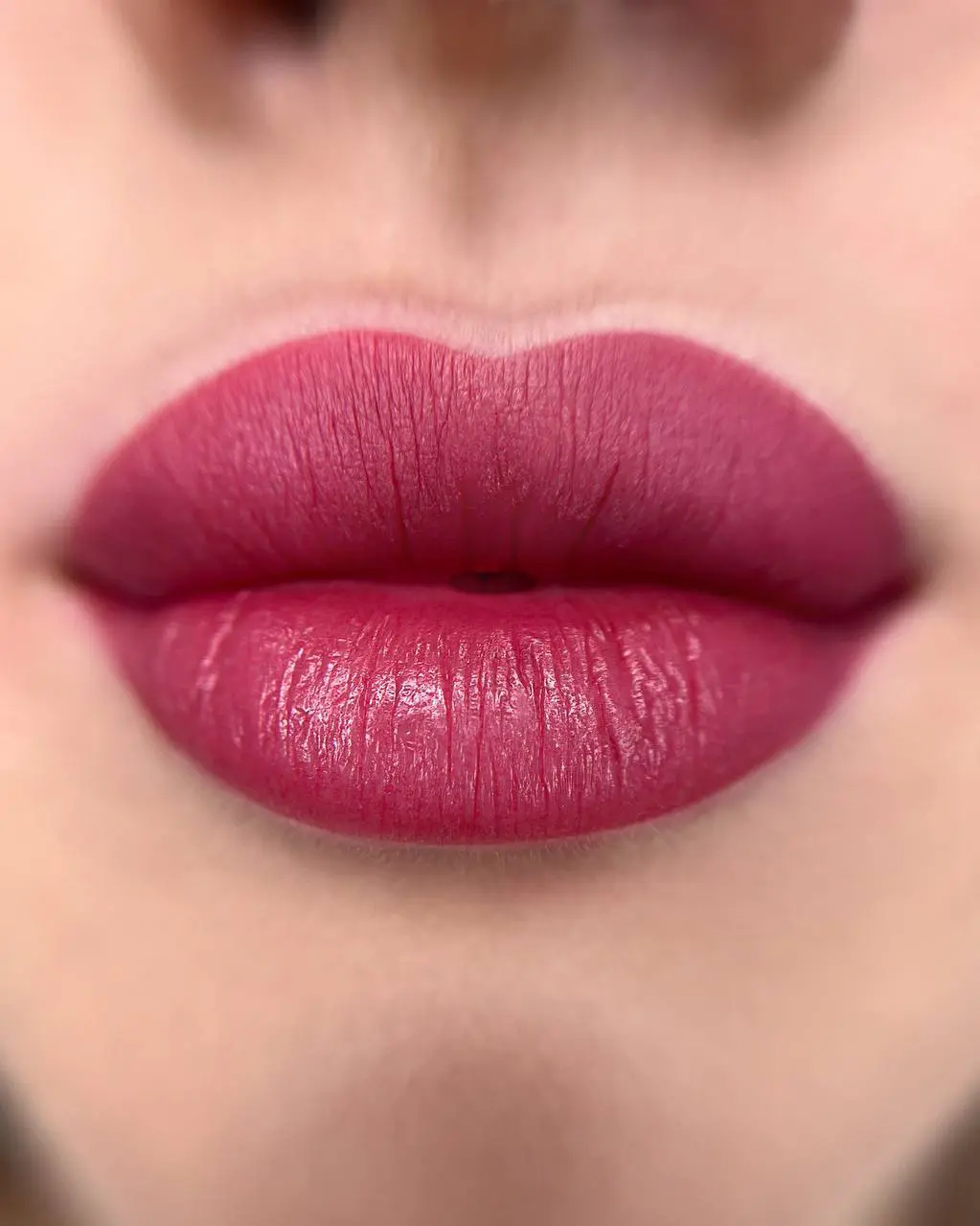 TRATAMIENTOS 3 &ndash; Helena SOL ⇢ Micropigmentación en Barcelona Helena SOL | Micropigmentación en Barcelona